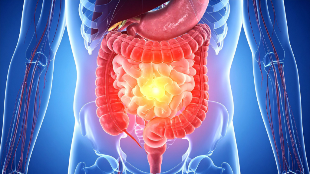 gut health for eczema