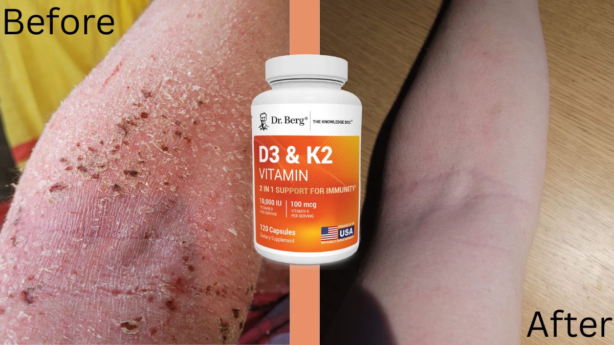 Dr. Berg's D3 & K2 Personal Review