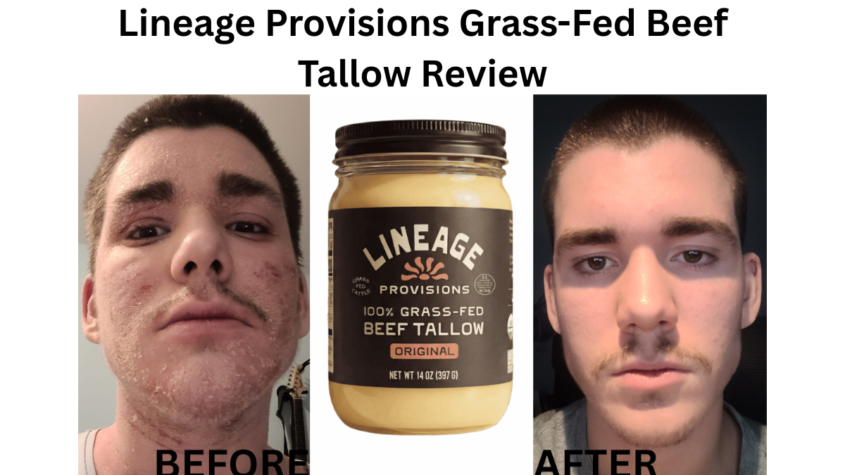 Lineage Provisions Grass-Fed Beef Tallow Review: Best tallow for eczema lineage beef tallow review for eczema