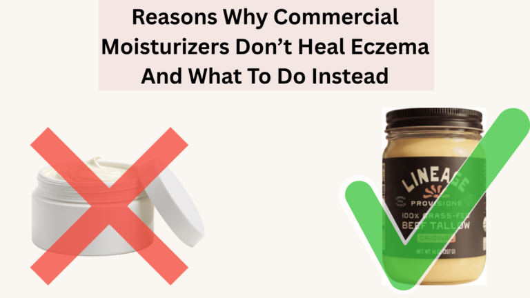5 Reasons Why Commercial Moisturizers Don’t Heal Eczema And What To Do Instead